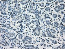 GBP2 Antibody - Immunohistochemical staining of paraffin-embedded breast tissue using anti-GBP2 mouse monoclonal antibody. (Dilution 1:50).