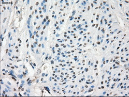 GBP2 Antibody - Immunohistochemical staining of paraffin-embedded endometrium tissue using anti-GBP2 mouse monoclonal antibody. (Dilution 1:50).