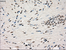 GBP2 Antibody - Immunohistochemical staining of paraffin-embedded prostate tissue using anti-GBP2 mouse monoclonal antibody. (Dilution 1:50).