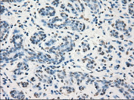 GBP2 Antibody - IHC of paraffin-embedded breast tissue using anti-GBP2 mouse monoclonal antibody. (Dilution 1:50).