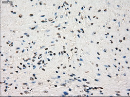 GBP2 Antibody - IHC of paraffin-embedded prostate tissue using anti-GBP2 mouse monoclonal antibody. (Dilution 1:50).