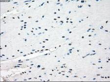 GBP2 Antibody - IHC of paraffin-embedded colon tissue using anti-GBP2 mouse monoclonal antibody. (Dilution 1:50).