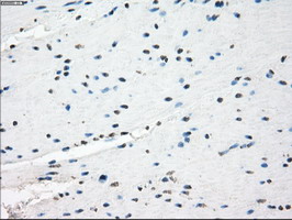 GBP2 Antibody - IHC of paraffin-embedded colon tissue using anti-GBP2 mouse monoclonal antibody. (Dilution 1:50).