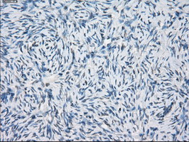 GBP2 Antibody - IHC of paraffin-embedded Ovary tissue using anti-GBP2 mouse monoclonal antibody. (Dilution 1:50).