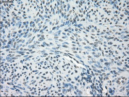 GBP2 Antibody - IHC of paraffin-embedded endometrium tissue using anti-GBP2 mouse monoclonal antibody. (Dilution 1:50).