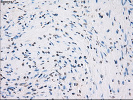 GBP2 Antibody - IHC of paraffin-embedded prostate tissue using anti-GBP2 mouse monoclonal antibody. (Dilution 1:50).