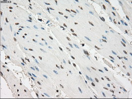 GBP2 Antibody - IHC of paraffin-embedded bladder tissue using anti-GBP2 mouse monoclonal antibody. (Dilution 1:50).