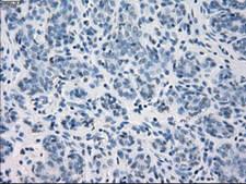 GBP2 Antibody - IHC of paraffin-embedded Human breast tissue using anti-GBP2 mouse monoclonal antibody.