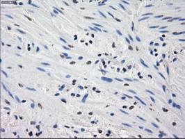 GBP2 Antibody - IHC of paraffin-embedded Human colon tissue using anti-GBP2 mouse monoclonal antibody.