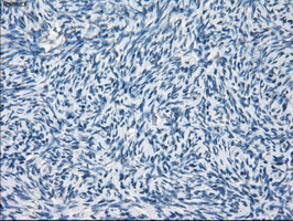 GBP2 Antibody - IHC of paraffin-embedded Human Ovary tissue using anti-GBP2 mouse monoclonal antibody.