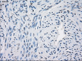 GBP2 Antibody - IHC of paraffin-embedded Human endometrium tissue using anti-GBP2 mouse monoclonal antibody.