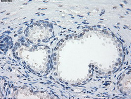 GBP2 Antibody - IHC of paraffin-embedded Human prostate tissue using anti-GBP2 mouse monoclonal antibody.