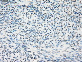 GBP2 Antibody - IHC of paraffin-embedded endometrium tissue using anti-GBP2 mouse monoclonal antibody. (Dilution 1:50).