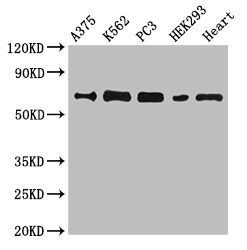 GBP2 Antibody - Positive WB detected in:A375 whole cell lysate,K562 whole cell lysate,PC3 whole cell lysate,HEK293 whole cell lysate,Mouse heart tissue;All lanes:GBP2 antibody at 6.2ug/ml;Secondary;Goat polyclonal to rabbit IgG at 1/50000 dilution;Predicted band size: 68 kDa;Observed band size: 68 kDa;