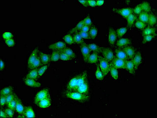 GBP2 Antibody - Immunofluorescent analysis of HepG2 cells using GBP2 Antibody at a dilution of 1:100 and Alexa Fluor 488-congugated AffiniPure Goat Anti-Rabbit IgG(H+L)