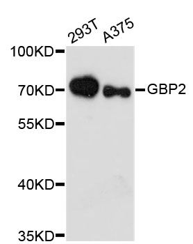 GBP2 Antibody - Western blot analysis of extracts of various cell lines, using GBP2 antibody at 1:3000 dilution. The secondary antibody used was an HRP Goat Anti-Rabbit IgG (H+L) at 1:10000 dilution. Lysates were loaded 25ug per lane and 3% nonfat dry milk in TBST was used for blocking. An ECL Kit was used for detection and the exposure time was 90s.