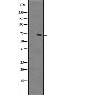 GBP2 Antibody - Western blot analysis of GBP2 expression in human liver tissue lysate. The lane on the left is treated with the antigen-specific peptide.