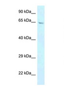 GBP3 Antibody - GBP3 antibody Western blot of Placenta lysate. Antibody concentration 1 ug/ml.  This image was taken for the unconjugated form of this product. Other forms have not been tested.