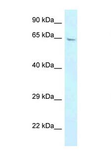 GBP3 Antibody - GBP3 antibody Western blot of Placenta lysate. Antibody concentration 1 ug/ml.  This image was taken for the unconjugated form of this product. Other forms have not been tested.