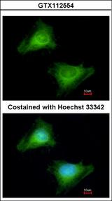 GBP3 Antibody - Immunofluorescence of methanol-fixed HeLa using Guanylate binding protein 3 antibody at 1:200 dilution.