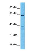GBP3 Antibody - Western blot of GBP3 Antibody with human 721_B Whole Cell lysate.  This image was taken for the unconjugated form of this product. Other forms have not been tested.