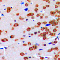 GBP3 Antibody - Immunohistochemical analysis of GBP3 staining in human brain formalin fixed paraffin embedded tissue section. The section was pre-treated using heat mediated antigen retrieval with sodium citrate buffer (pH 6.0). The section was then incubated with the antibody at room temperature and detected using an HRP conjugated compact polymer system. DAB was used as the chromogen. The section was then counterstained with hematoxylin and mounted with DPX.