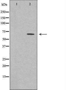 GBP3 Antibody - Western blot analysis of extracts of COLO cells using GBP3 antibody. The lane on the left is treated with the antigen-specific peptide.