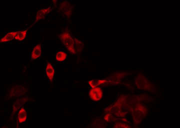 GBP3 Antibody - Staining HT29 cells by IF/ICC. The samples were fixed with PFA and permeabilized in 0.1% Triton X-100, then blocked in 10% serum for 45 min at 25°C. The primary antibody was diluted at 1:200 and incubated with the sample for 1 hour at 37°C. An Alexa Fluor 594 conjugated goat anti-rabbit IgG (H+L) Ab, diluted at 1/600, was used as the secondary antibody.