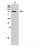 GBP4 / Mpa2 Antibody - Western blot of GBP4 antibody