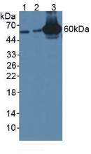 GBP4 / Mpa2 Antibody - Western Blot; Sample: Lane1: Mouse Serum; Lane2: Mouse Placenta Tissue; Lane3: Mouse Pancreas Tissue.