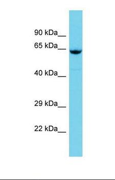 GBP5 Antibody - Western blot of Human Lymph Node Tumor. GBP5 antibody dilution 1.0 ug/ml.  This image was taken for the unconjugated form of this product. Other forms have not been tested.