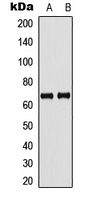 GBP5 Antibody - Western blot analysis of GBP5 expression in human placenta (A); rat kidney (B) whole cell lysates.