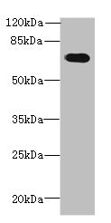 GBP5 Antibody - Western blot All lanes: GBP5 antibody at 6µg/ml + Mouse thymus tissue Secondary Goat polyclonal to rabbit IgG at 1/10000 dilution Predicted band size: 67, 56 kDa Observed band size: 67 kDa
