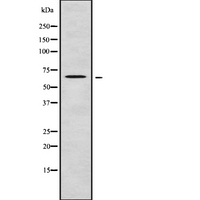GBP5 Antibody - Western blot analysis GBP5 using COLO205 whole cells lysates