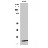GBTS1 / DIRAS1 Antibody - Western blot of Di-Ras1 antibody