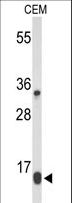 GBTS1 / DIRAS1 Antibody - Western blot of DIRAS1 Antibody in CEM cell line lysates (35 ug/lane). DIRAS1 (arrow) was detected using the purified antibody.