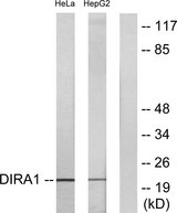 GBTS1 / DIRAS1 Antibody - Western blot analysis of lysates from HeLa and HepG2 cells, using DIRA1 Antibody. The lane on the right is blocked with the synthesized peptide.
