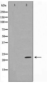 GBTS1 / DIRAS1 Antibody - Western blot of HeLa cell lysate using DIRA1 Antibody