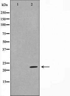 GBTS1 / DIRAS1 Antibody - Western blot analysis on HeLa cell lysates using DIRA1 antibody. The lane on the left is treated with the antigen-specific peptide.