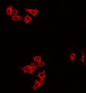 GBTS1 / DIRAS1 Antibody - Staining HeLa cells by IF/ICC. The samples were fixed with PFA and permeabilized in 0.1% Triton X-100, then blocked in 10% serum for 45 min at 25°C. The primary antibody was diluted at 1:200 and incubated with the sample for 1 hour at 37°C. An Alexa Fluor 594 conjugated goat anti-rabbit IgG (H+L) Ab, diluted at 1/600, was used as the secondary antibody.