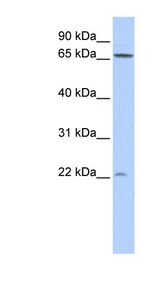 GBTS1 / DIRAS1 Antibody - DIRAS1 antibody Western blot of 293T cell lysate. This image was taken for the unconjugated form of this product. Other forms have not been tested.