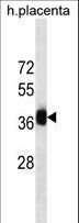 GBX2 Antibody - GBX2 Antibody western blot of human placenta tissue lysates (35 ug/lane). The GBX2 antibody detected the GBX2 protein (arrow).