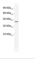 GBX2 Antibody - Jurkat Cell Lysate.  This image was taken for the unconjugated form of this product. Other forms have not been tested.