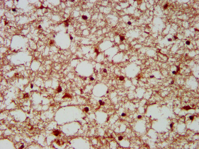 GBX2 Antibody - Immunohistochemistry image at a dilution of 1:300 and staining in paraffin-embedded human brain tissue performed on a Leica BondTM system. After dewaxing and hydration, antigen retrieval was mediated by high pressure in a citrate buffer (pH 6.0) . Section was blocked with 10% normal goat serum 30min at RT. Then primary antibody (1% BSA) was incubated at 4 °C overnight. The primary is detected by a biotinylated secondary antibody and visualized using an HRP conjugated SP system.