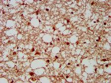 GBX2 Antibody - Immunohistochemistry image at a dilution of 1:300 and staining in paraffin-embedded human brain tissue performed on a Leica BondTM system. After dewaxing and hydration, antigen retrieval was mediated by high pressure in a citrate buffer (pH 6.0) . Section was blocked with 10% normal goat serum 30min at RT. Then primary antibody (1% BSA) was incubated at 4 °C overnight. The primary is detected by a biotinylated secondary antibody and visualized using an HRP conjugated SP system.