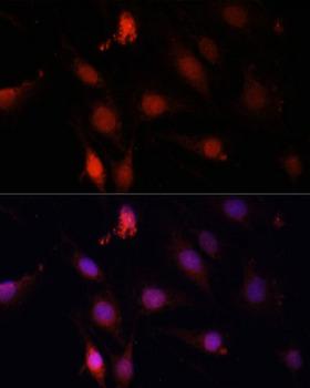 GBX2 Antibody - Immunofluorescence analysis of C6 cells using GBX2 Polyclonal Antibody at dilution of 1:100.Blue: DAPI for nuclear staining.