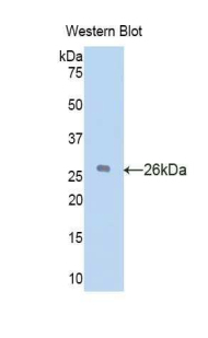 GC / Vitamin D-Binding Protein Antibody - Western blot of recombinant GC / Vitamin D-Binding Protein.  This image was taken for the unconjugated form of this product. Other forms have not been tested.