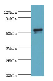 GC / Vitamin D-Binding Protein Antibody - Western blot. All lanes: GC antibody at 2 ug/ml+mouse liver tissue. Secondary antibody: Goat polyclonal to rabbit at 1:10000 dilution. Predicted band size: 53 kDa. Observed band size: 53 kDa Immunohistochemistry.