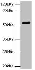 GC / Vitamin D-Binding Protein Antibody - Western blot All lanes: GC antibody at 2µg/ml + Mouse liver tissue Secondary Goat polyclonal to rabbit IgG at 1/10000 dilution Predicted band size: 53, 40, 56 kDa Observed band size: 53 kDa