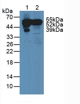 GC / Vitamin D-Binding Protein Antibody - Western Blot; Sample: Lane1: Human Serum; Lane2: Human Liver Tissue.